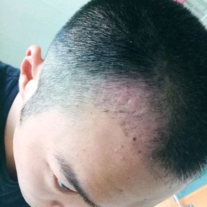 发际线分享社区
