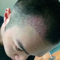 發(fā)際線用戶圖片