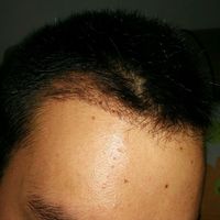 發(fā)際線用戶圖片