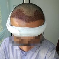 發(fā)際線用戶圖片