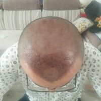 發(fā)際線用戶圖片