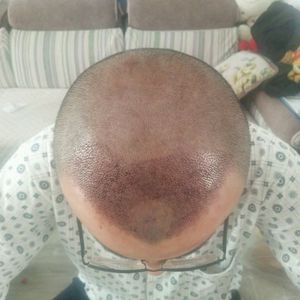 发际线分享社区
