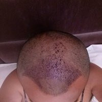 發(fā)際線用戶圖片