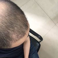 發(fā)際線用戶圖片
