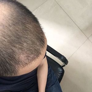 发际线分享社区