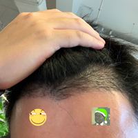 發(fā)際線用戶圖片