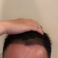 發(fā)際線用戶圖片