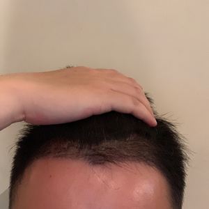 发际线分享社区