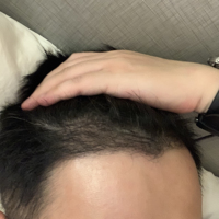 發(fā)際線用戶圖片