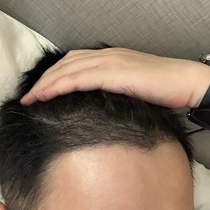 发际线分享社区