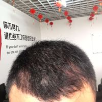 發(fā)際線用戶圖片