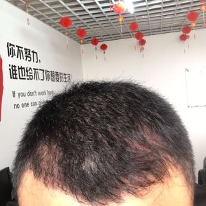 发际线分享社区