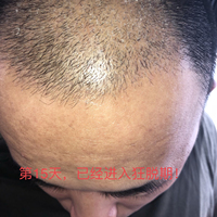 發(fā)際線用戶圖片