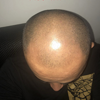 發(fā)際線用戶圖片