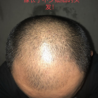 發(fā)際線用戶圖片