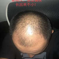 發(fā)際線用戶圖片