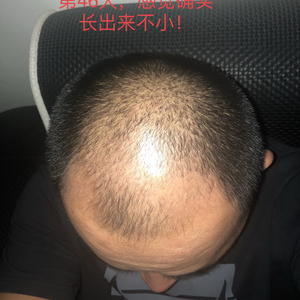 发际线分享社区