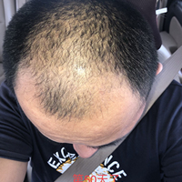 發(fā)際線用戶圖片
