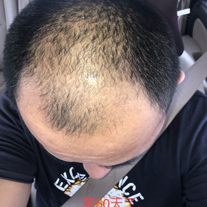 发际线分享社区