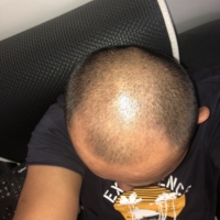 發(fā)際線用戶圖片