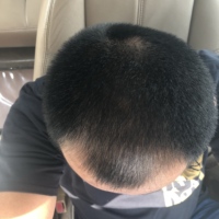 發(fā)際線用戶圖片
