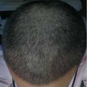 发际线分享社区