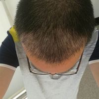 發(fā)際線用戶圖片