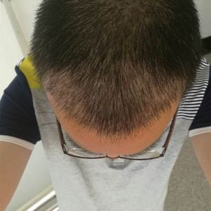 发际线分享社区