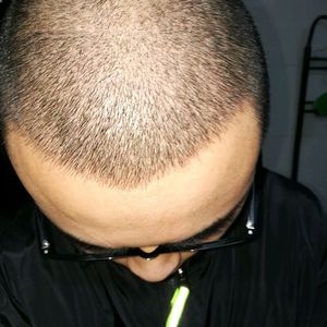 发际线分享社区