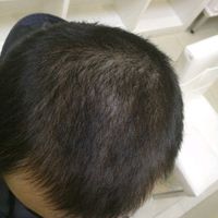 發(fā)際線用戶圖片