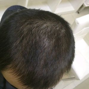 发际线分享社区