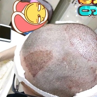 禿頂用戶圖片