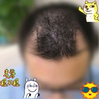 發(fā)際線用戶圖片