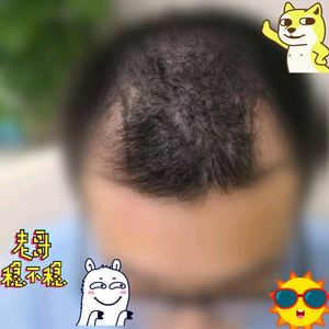 发际线分享社区
