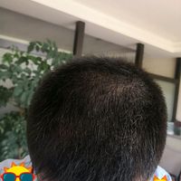 發(fā)際線用戶圖片