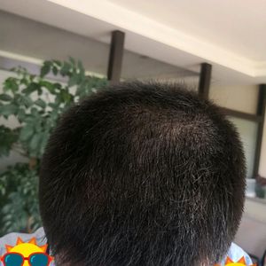 发际线分享社区