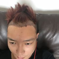 發(fā)際線用戶圖片
