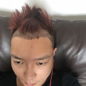 发际线分享社区