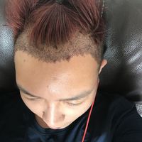 發(fā)際線用戶圖片