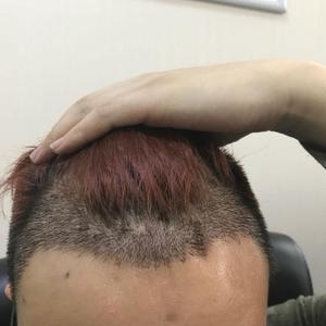 发际线分享社区