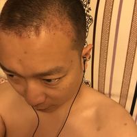 發(fā)際線用戶圖片