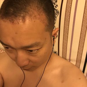 发际线分享社区