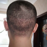發(fā)際線用戶圖片
