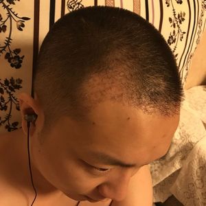 发际线分享社区