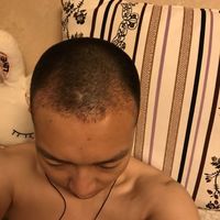 發(fā)際線用戶圖片
