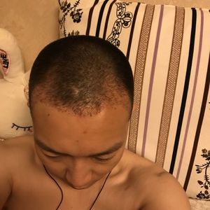 发际线分享社区