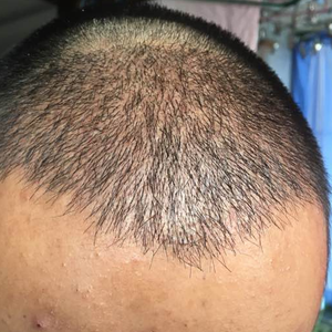 发际线分享社区