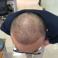 發(fā)際線用戶圖片
