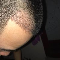 發(fā)際線用戶圖片
