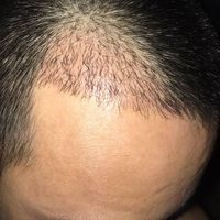 發(fā)際線用戶圖片